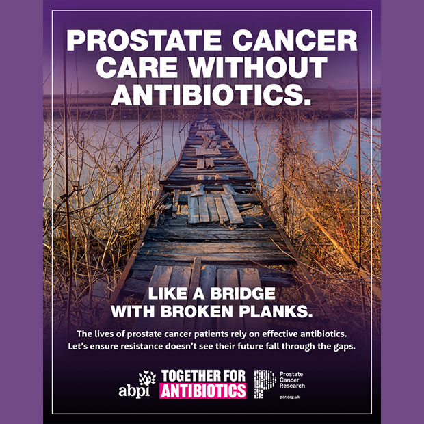 Bridge Planks Cover