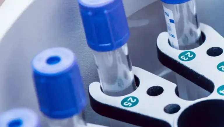 Close up of vials in a centrifuge