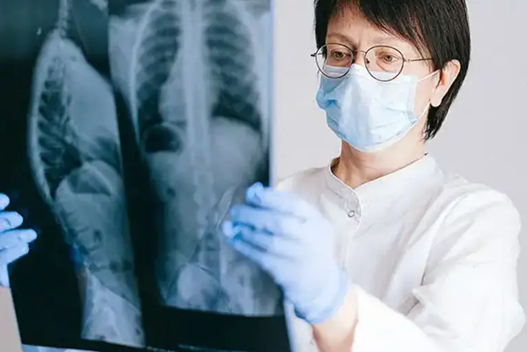 Masked doctor holds up and examines a chest X-ray
