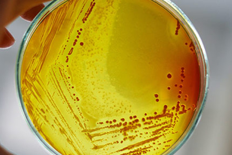 New approach to antibiotics good news for patients