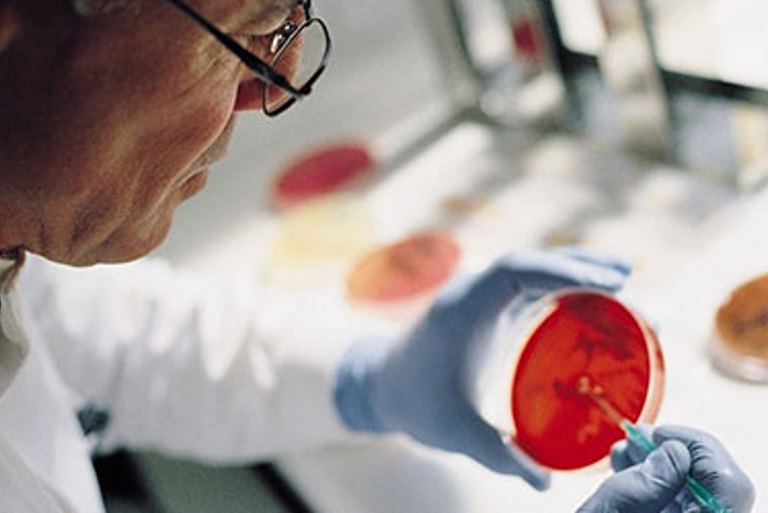 Scientist examining an agar dish